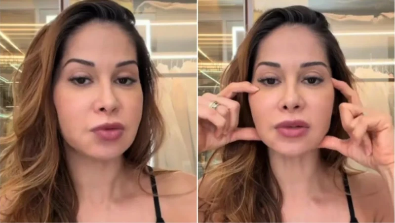 Maíra Cardi revela descoberta de uso de preenchedor permanente e detalha cirurgia para retirada
