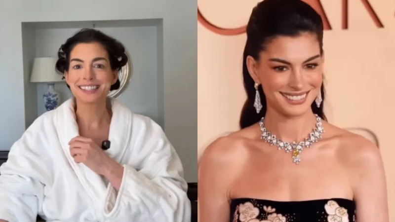 'Facelift' sem cirurgia: Anne Hathaway revela truque que usou no Oscar 2026; saiba como copiar