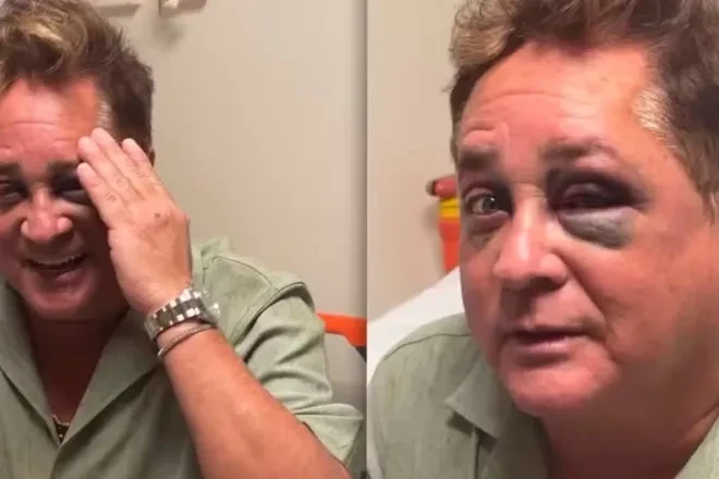 Leonardo é hospitalizado após acidente em barco