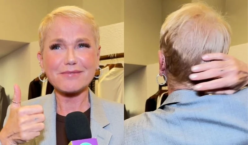 Xuxa revela transplante capilar e desabafa sobre alopecia